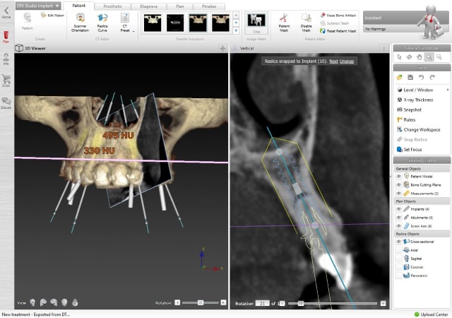 digital-x-ray-planning-img digital-x-ray-planning-img