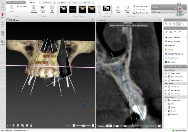 digital-x-ray-planning-img